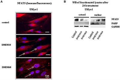 Localization and Expression of Nuclear Factor of Activated T-Cells 5 in Myoblasts Exposed to Pro-inflammatory Cytokines or Hyperosmolar Stress and in Biopsies from Myositis Patients